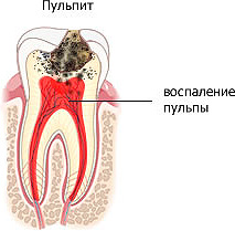 Стоматология терапевтическая